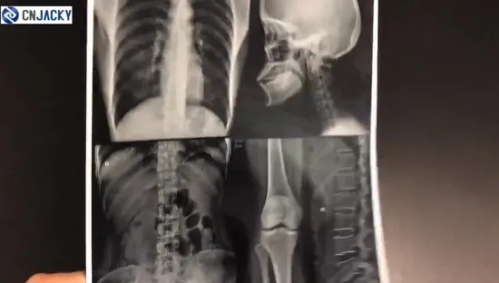 High Precision Digital Printing White Base Inkjet Medical X